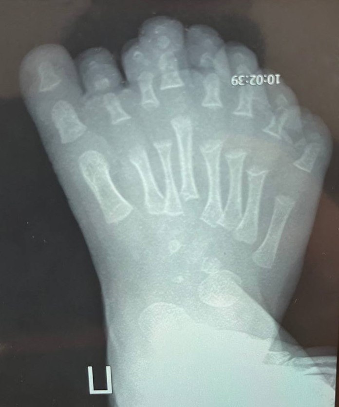 post-22583 thumbnail