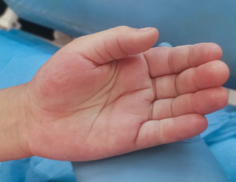 post-25477 thumbnail